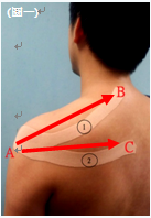 圖一: 肌肉運動貼布之頸肩部貼法