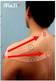 Figure 1: taping method for neck and shoulder 