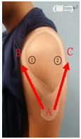 圖二: 肌肉運動貼布之肩部貼法
