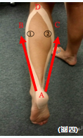 圖四: 肌肉運動貼布之足部疲勞貼法