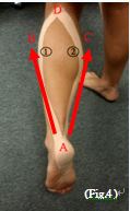 Figure 4: taping method for foot fatigue 
